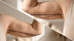 Wiotkie ramiona? 3 proste ćwiczenia od trenera fitness