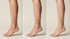 Bez obrzęków: moja kompletna rutyna przeciwko obrzękom, która zawsze mi pomaga